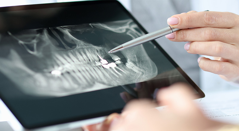 丁寧な治療をお約束します