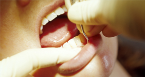 トラブルを防止できる！